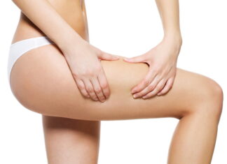 female-squeezes-cellulite-skin-her-legs